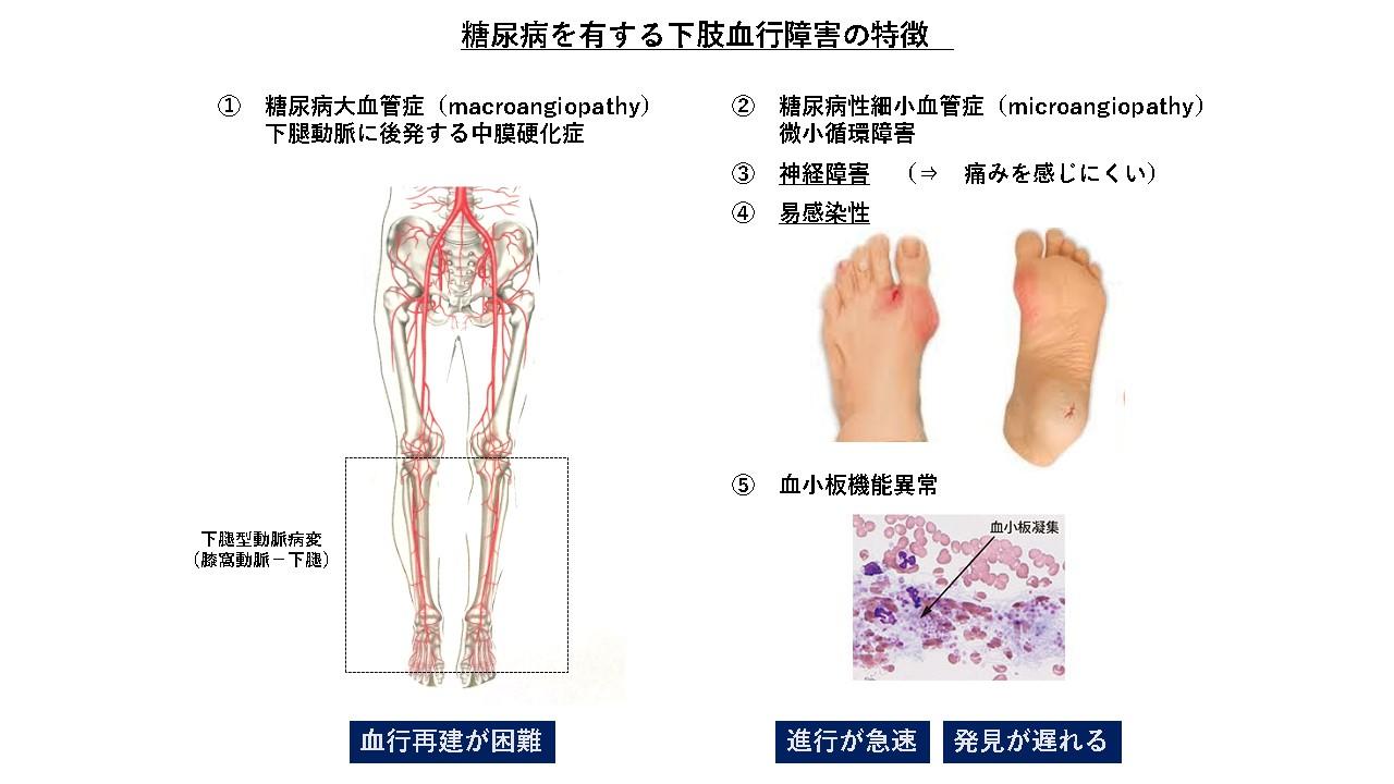 症状 凍傷