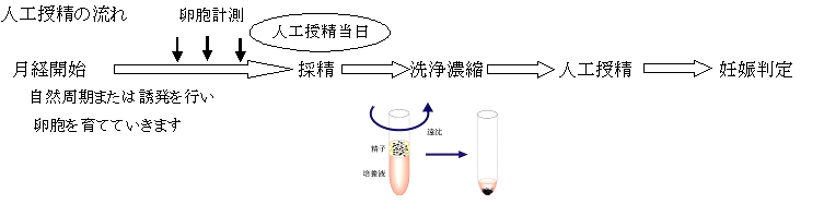 人工授精の流れ編集後.png