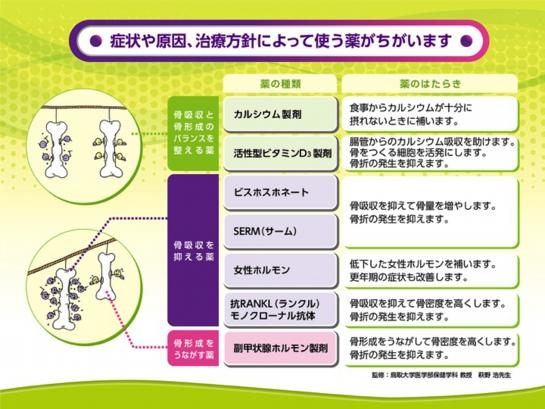 セニャレスとシントマス