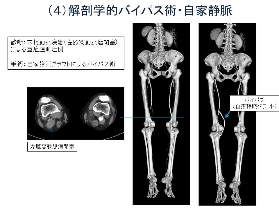 スライド9.JPG